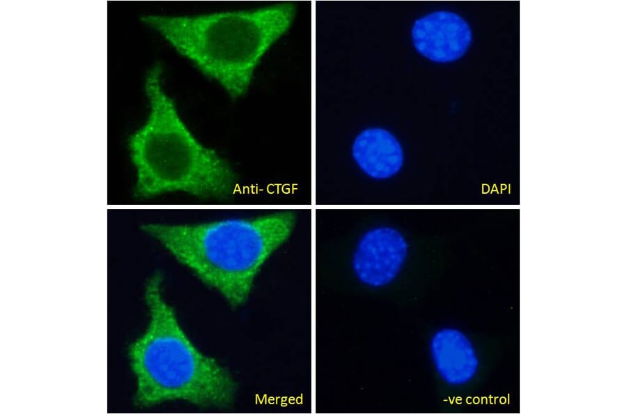 Immunofluorescence - Anti-CTGF Antibody (A285947) - Antibodies.com