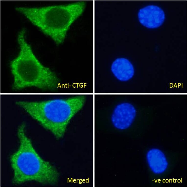 Immunofluorescence - Anti-CTGF Antibody (A285947) - Antibodies.com