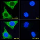 Immunofluorescence - Anti-CTGF Antibody (A285947) - Antibodies.com