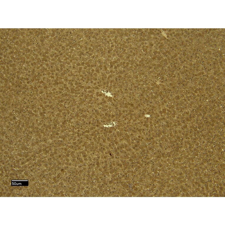 Immunohistochemistry - Anti-CTGF Antibody (A285947) - Antibodies.com