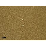 Immunohistochemistry - Anti-CTGF Antibody (A285947) - Antibodies.com