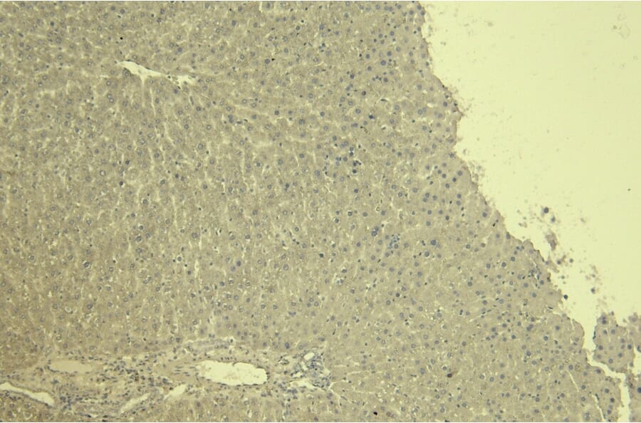 Immunohistochemistry - Anti-CTGF Antibody (A285947) - Antibodies.com