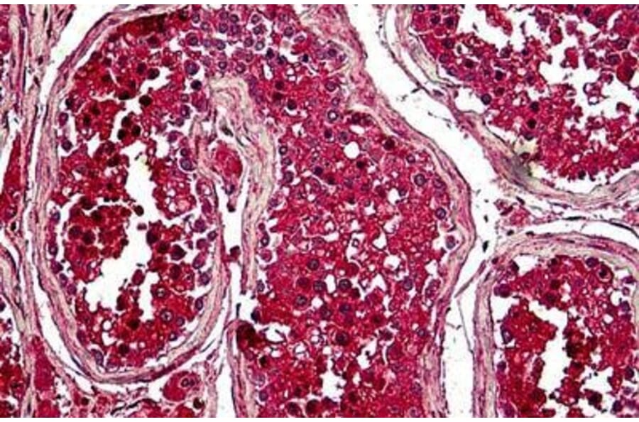 Immunohistochemistry - Anti-Securin Antibody (A285949) - Antibodies.com