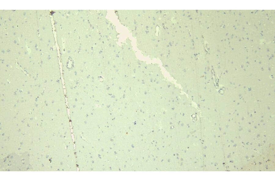 Immunohistochemistry - Anti-Nav1.5/SCN5A Antibody (A285952) - Antibodies.com