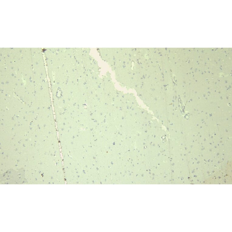 Immunohistochemistry - Anti-Nav1.5/SCN5A Antibody (A285952) - Antibodies.com