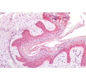 Immunohistochemistry - Anti-RSK2 Antibody (A285954) - Antibodies.com