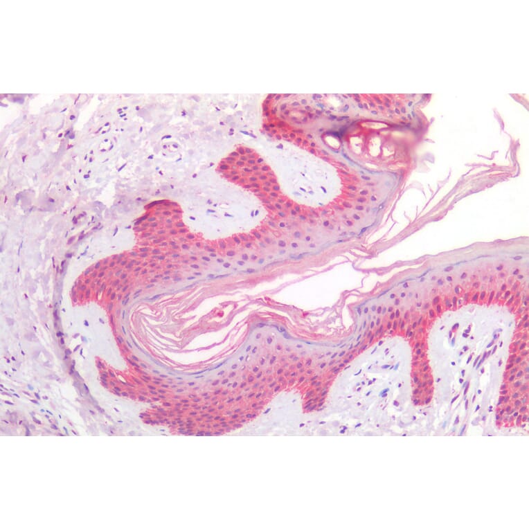 Immunohistochemistry - Anti-RSK2 Antibody (A285954) - Antibodies.com