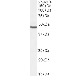 Western Blot - Anti-Sonic Hedgehog Antibody (A285956) - Antibodies.com