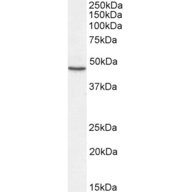 Western Blot - Anti-Sonic Hedgehog Antibody (A285956) - Antibodies.com