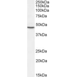 Western Blot - Anti-Sonic Hedgehog Antibody (A285956) - Antibodies.com