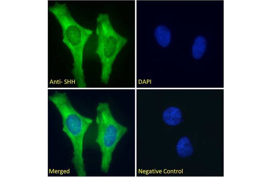 Immunofluorescence - Anti-Sonic Hedgehog Antibody (A285956) - Antibodies.com