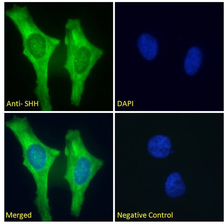 Immunofluorescence - Anti-Sonic Hedgehog Antibody (A285956) - Antibodies.com