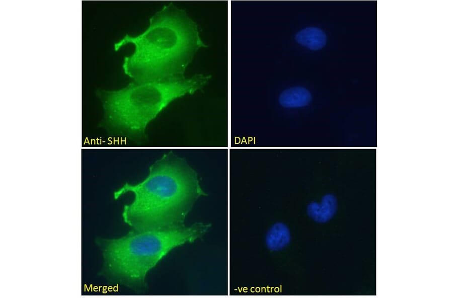 Immunofluorescence - Anti-Sonic Hedgehog Antibody (A285956) - Antibodies.com