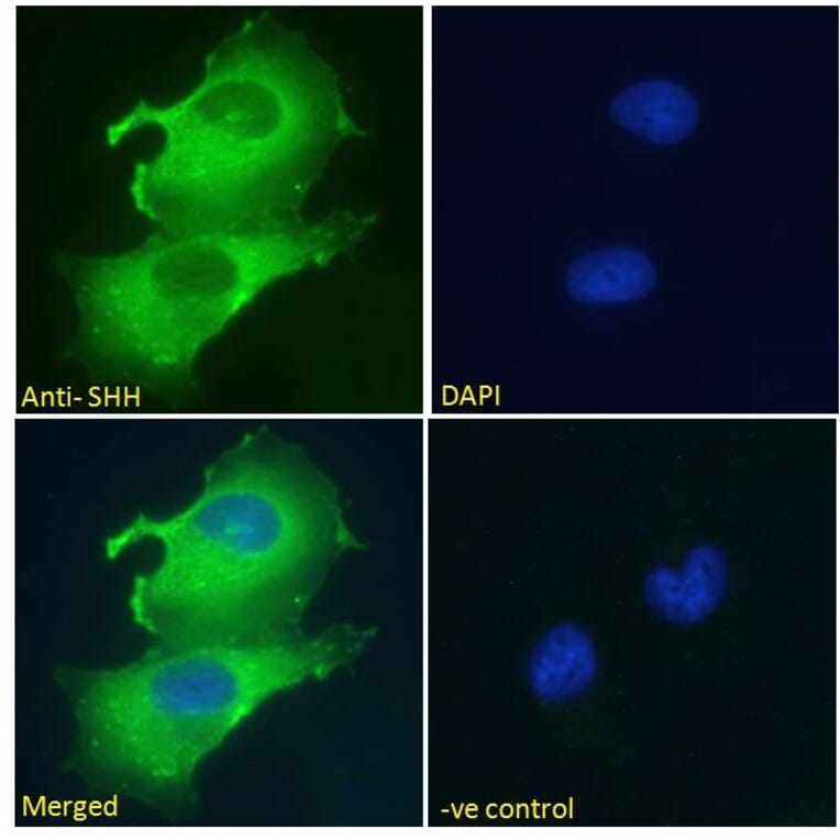 Immunofluorescence - Anti-Sonic Hedgehog Antibody (A285956) - Antibodies.com