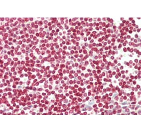 Immunohistochemistry - Anti-FOXP3 Antibody (A285957) - Antibodies.com