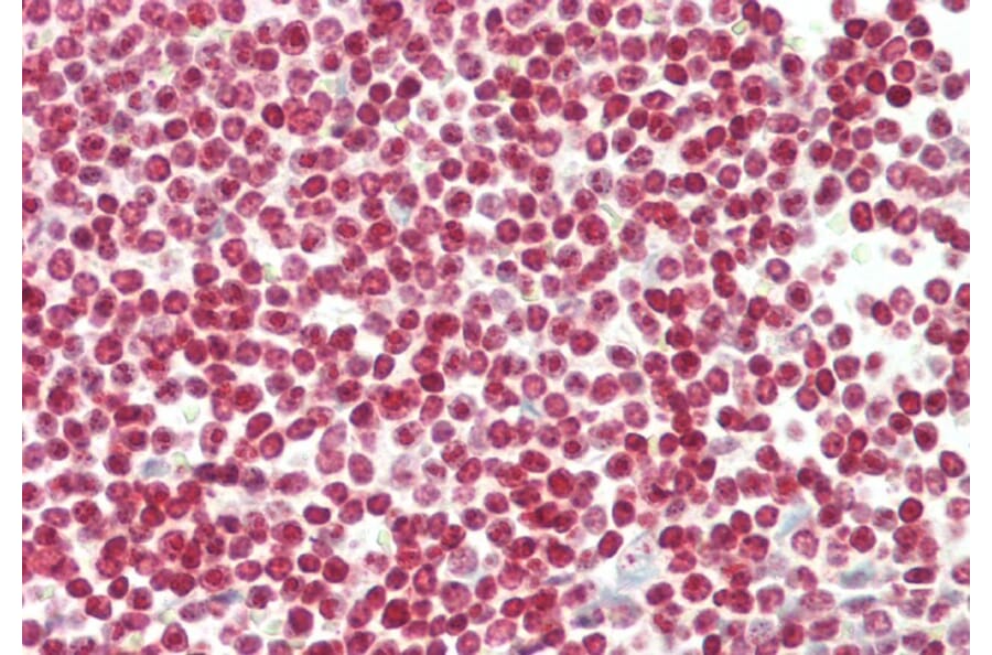 Immunohistochemistry - Anti-FOXP3 Antibody (A285957) - Antibodies.com