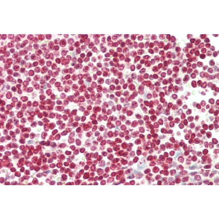 Immunohistochemistry - Anti-FOXP3 Antibody (A285957) - Antibodies.com