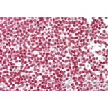 Immunohistochemistry - Anti-FOXP3 Antibody (A285957) - Antibodies.com