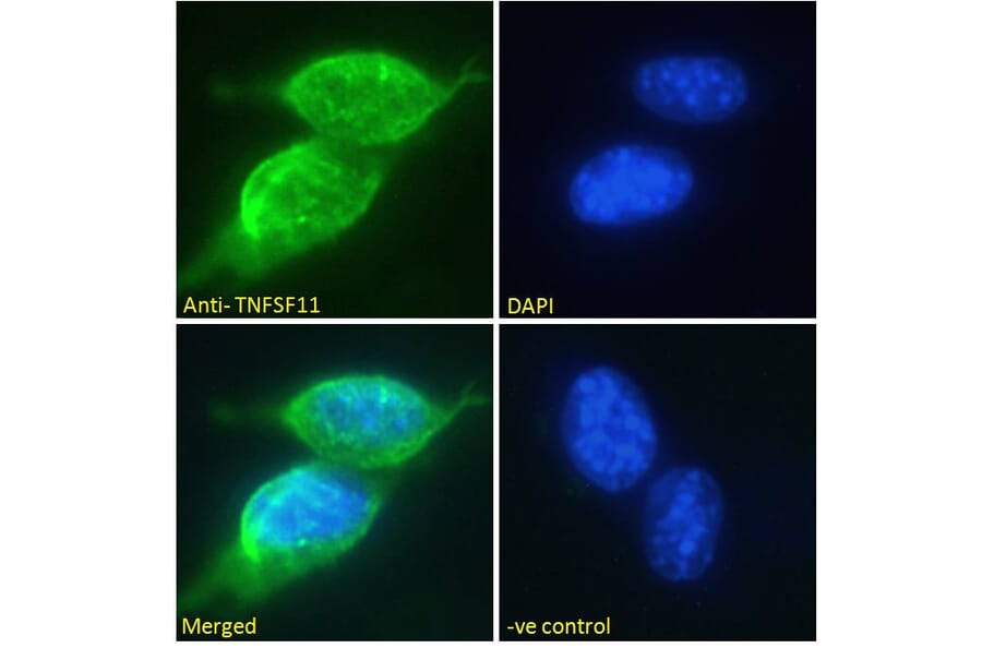 Immunofluorescence - Anti-RANKL Antibody (A285959) - Antibodies.com