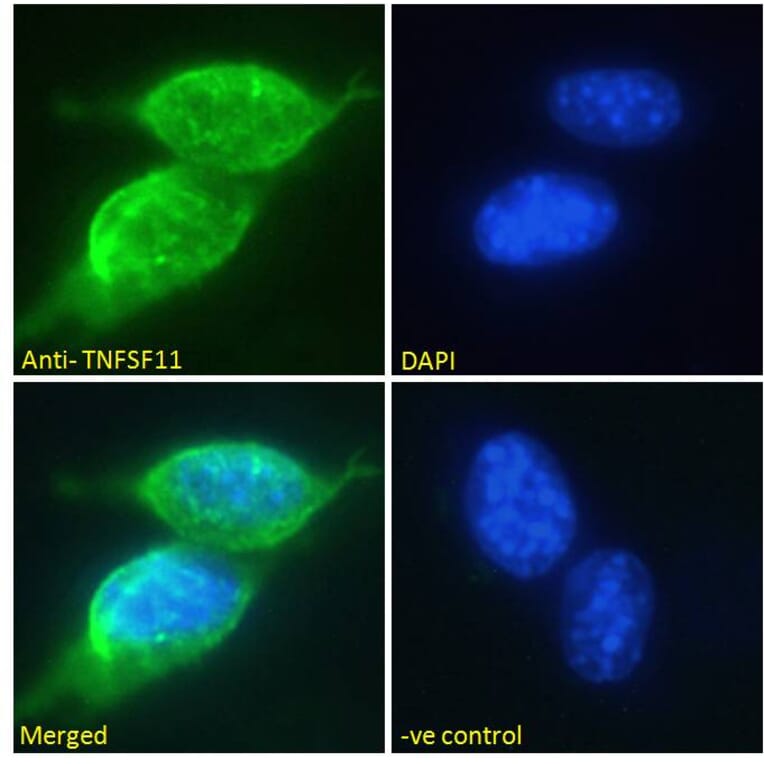 Immunofluorescence - Anti-RANKL Antibody (A285959) - Antibodies.com