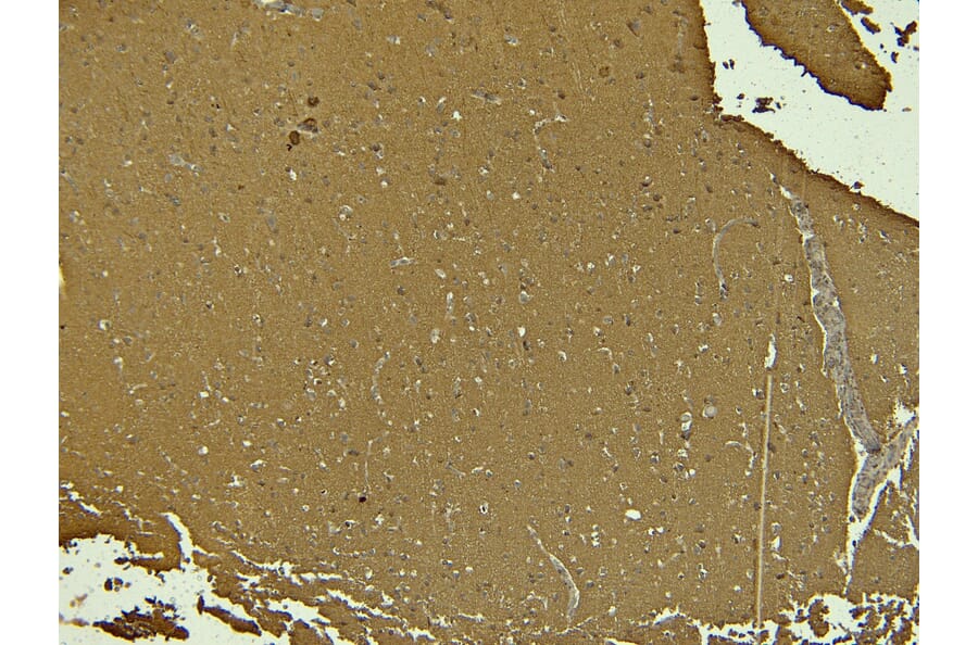 Immunohistochemistry - Anti-Doublecortin Antibody (A285962) - Antibodies.com