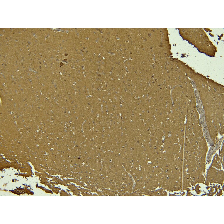 Immunohistochemistry - Anti-Doublecortin Antibody (A285962) - Antibodies.com