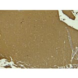 Immunohistochemistry - Anti-Doublecortin Antibody (A285962) - Antibodies.com