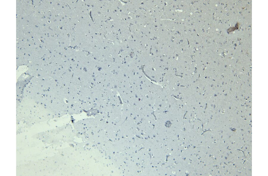 Immunohistochemistry - Anti-Doublecortin Antibody (A285962) - Antibodies.com
