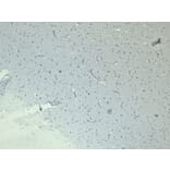 Immunohistochemistry - Anti-Doublecortin Antibody (A285962) - Antibodies.com