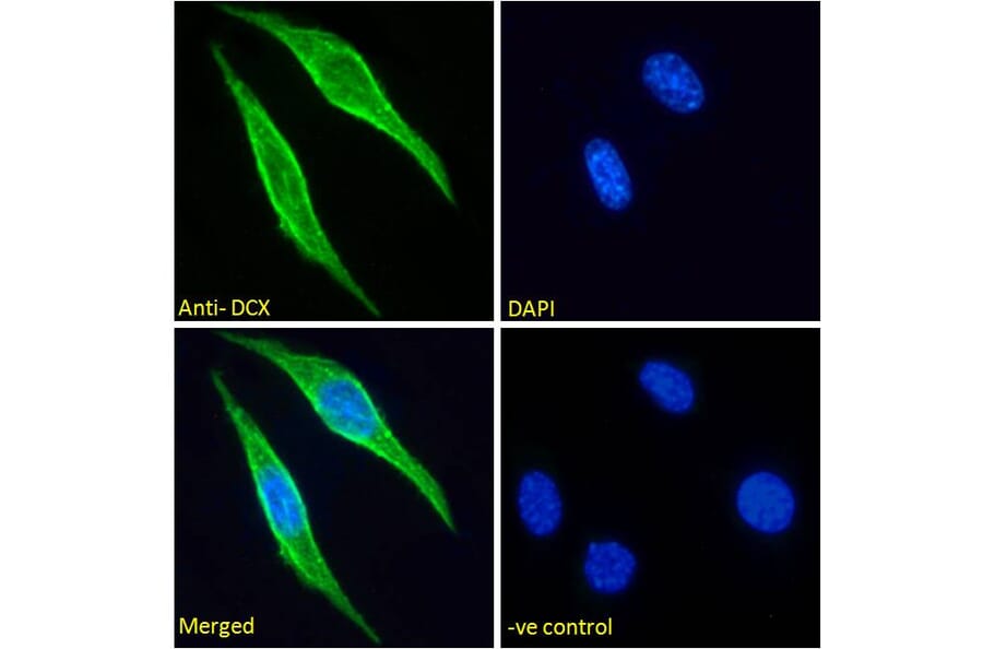 Immunofluorescence - Anti-Doublecortin Antibody (A285962) - Antibodies.com