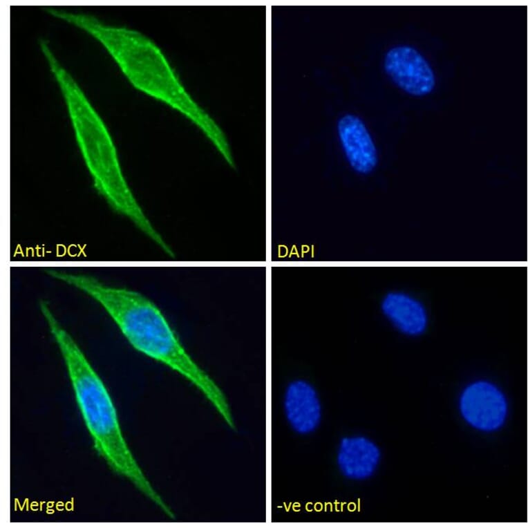 Immunofluorescence - Anti-Doublecortin Antibody (A285962) - Antibodies.com