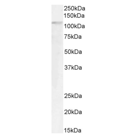 Western Blot - Anti-GTF2IRD1 Antibody (A285963) - Antibodies.com