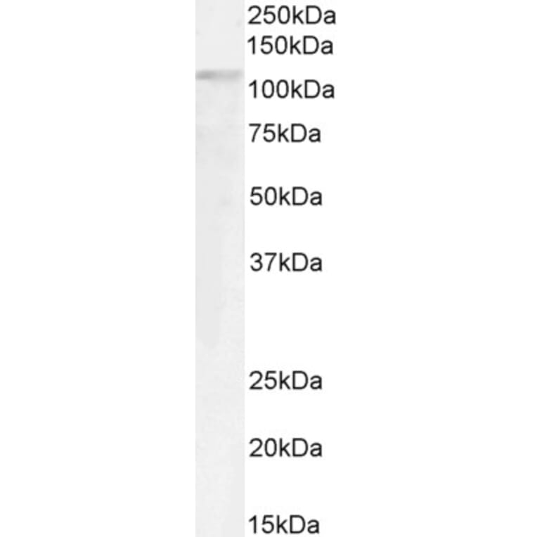 Western Blot - Anti-GTF2IRD1 Antibody (A285963) - Antibodies.com