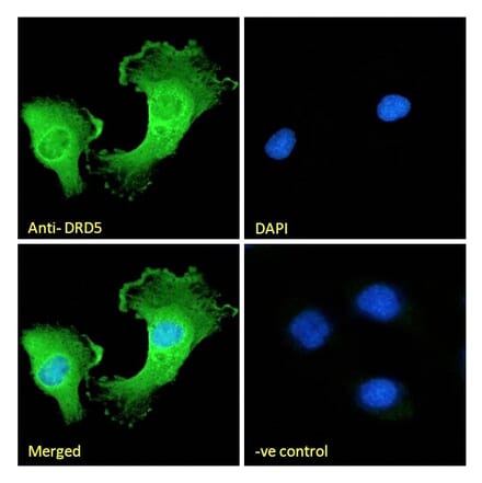 Immunofluorescence - Anti-DRD5 Antibody (A285965) - Antibodies.com