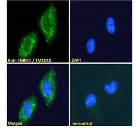 Immunofluorescence - Anti-TMP21 Antibody (A285969) - Antibodies.com