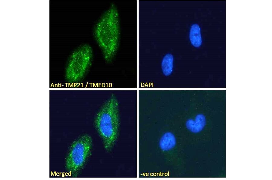 Immunofluorescence - Anti-TMP21 Antibody (A285969) - Antibodies.com
