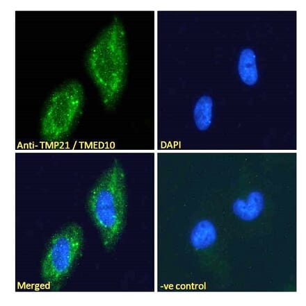 Immunofluorescence - Anti-TMP21 Antibody (A285969) - Antibodies.com