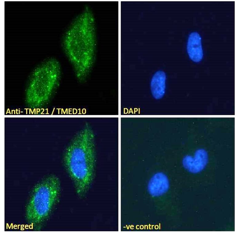 Immunofluorescence - Anti-TMP21 Antibody (A285969) - Antibodies.com