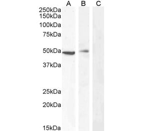 Western Blot - Anti-Carabin Antibody (A285971) - Antibodies.com