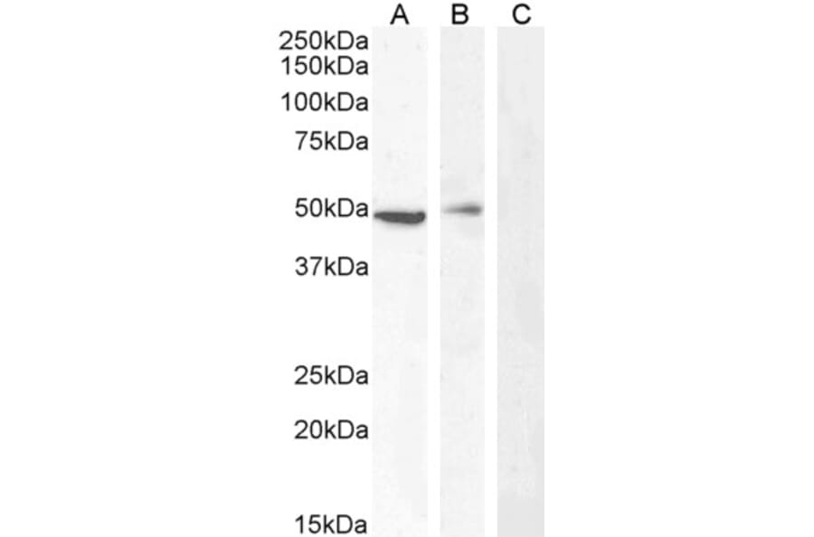 Western Blot - Anti-Carabin Antibody (A285971) - Antibodies.com