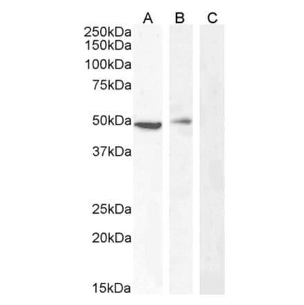 Western Blot - Anti-Carabin Antibody (A285971) - Antibodies.com