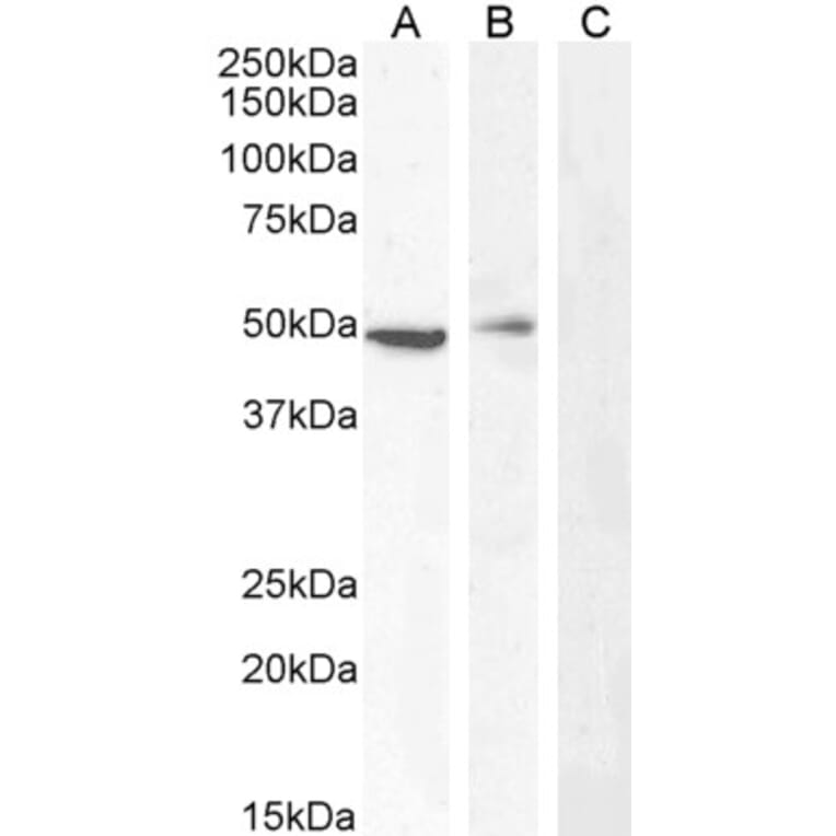 Western Blot - Anti-Carabin Antibody (A285971) - Antibodies.com