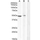 Western Blot - Anti-Carabin Antibody (A285971) - Antibodies.com