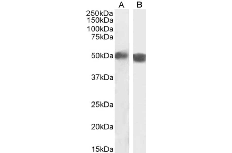 Western Blot - Anti-Carabin Antibody (A285971) - Antibodies.com