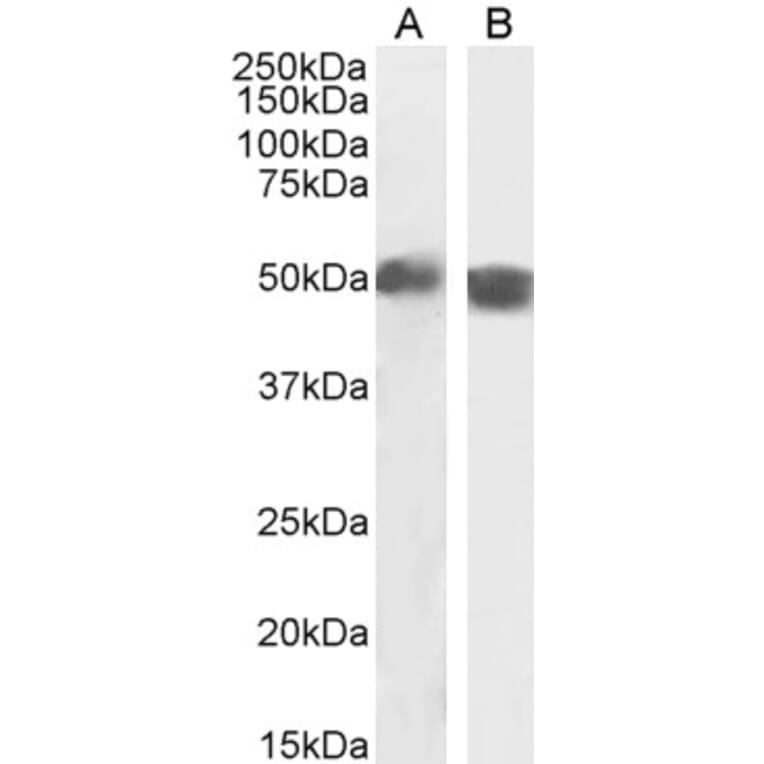 Western Blot - Anti-Carabin Antibody (A285971) - Antibodies.com