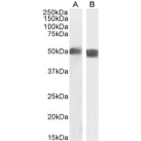 Western Blot - Anti-Carabin Antibody (A285971) - Antibodies.com