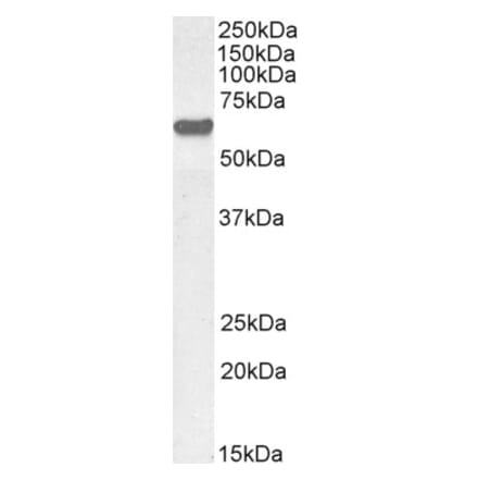 Western Blot - Anti-AKT1 Antibody (A285973) - Antibodies.com