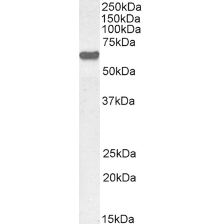 Western Blot - Anti-AKT1 Antibody (A285973) - Antibodies.com