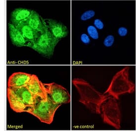 Immunofluorescence - Anti-CHD5 Antibody (A285975) - Antibodies.com