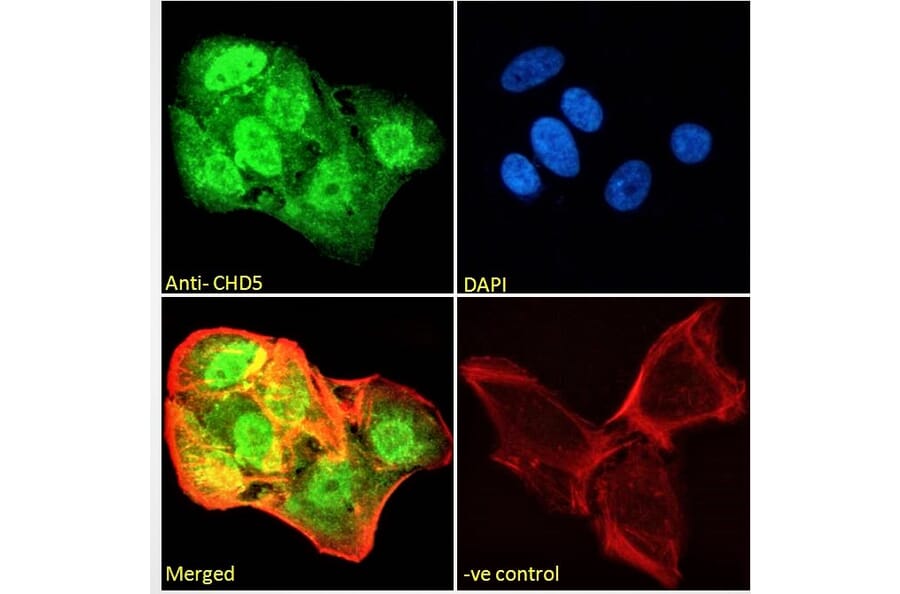 Immunofluorescence - Anti-CHD5 Antibody (A285975) - Antibodies.com